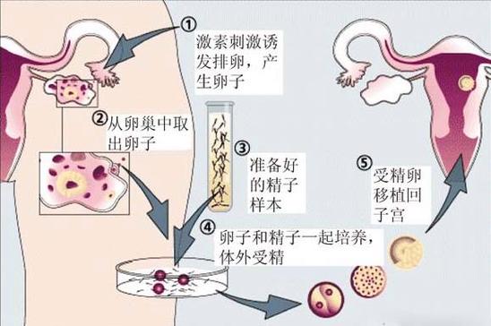 试管可以同时供卵供精吗【试管技术是否可以同时供卵供精？】