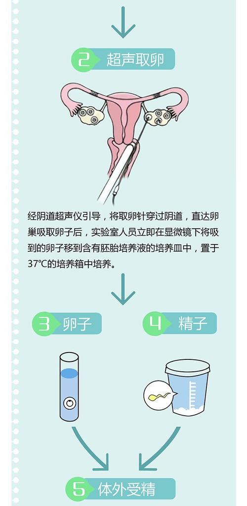 试管供卵试管代怀过程-试管供卵与代怀:全面解析试管供卵试管代怀过程