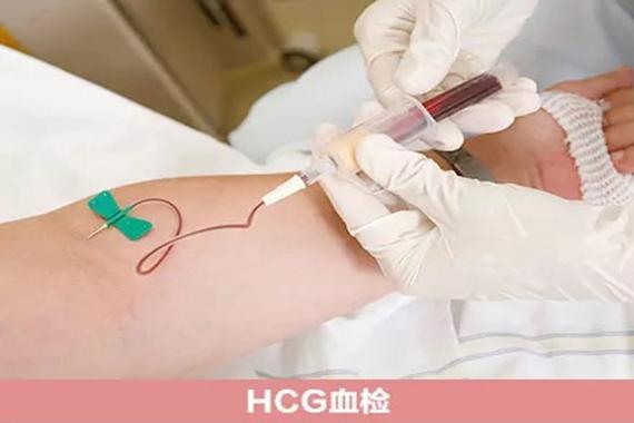 武汉三代供卵试管代怀-武汉三代供卵试管代怀:新生命的希望